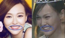 牙医爆料明星整牙视频大全,牙医爆料视频大全