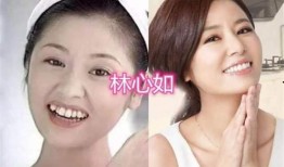 牙医爆料明星整牙视频大全,牙医爆料视频大全